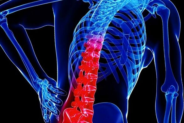 The causes of the development of thoracic osteochondrosis