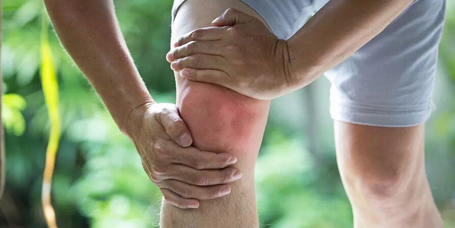 Severe pain during physical activity due to arthrosis of the knee joint